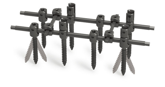 Multi Axial Broken Pedicle Screw Single Double Thread CE ISO 13485